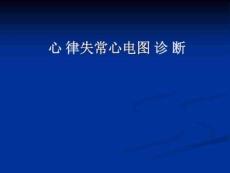 心律失常分类