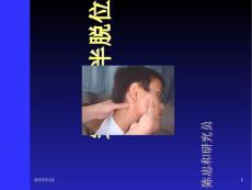 寰枢椎半脱位
