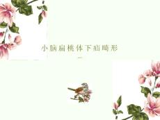 小脑扁桃体下疝影像诊断