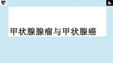 甲状腺腺瘤和甲状腺癌影像诊断