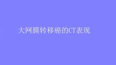 大网膜转移癌