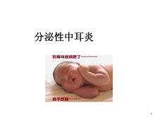 分泌性中耳炎-课件