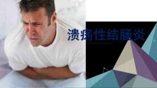 溃疡性结肠炎