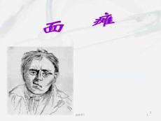面瘫--ppt课件