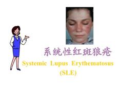系统性红斑狼疮39350
