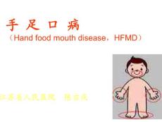 手足口病讲稿