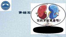 肾结石