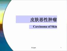 体表三大恶性肿瘤概述课件