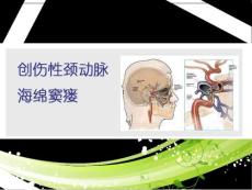 创伤性颈动脉海绵窦瘘课件
