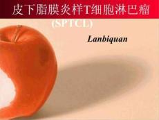 皮下脂膜炎样t细胞淋巴瘤