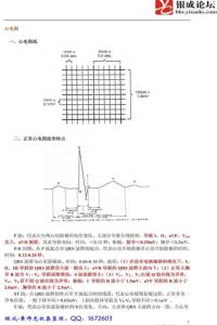 最詳細的心電圖教程
