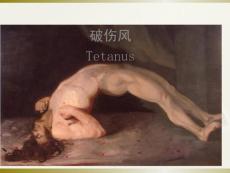 破伤风课件