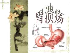 胃溃疡-课件