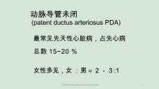 动脉导管未闭patentductusarteriosusPDAppt课件