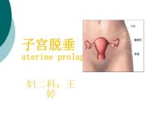 子宫脱垂PPT课件