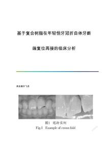 基于复合树脂在年轻恒牙冠折自体牙断端复位再接的临床分析