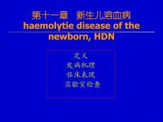 新生儿溶血课件
