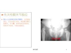 先天性髋关节脱位--课件