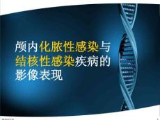 脑脓肿与脑结核的影像表现-课件