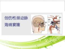 创伤性颈动脉海绵窦瘘课件