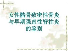 女性髂骨致密性骨炎与早期强直性脊柱炎的鉴别课件