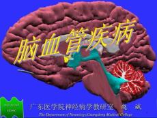 缺血性脑血管疾病课件