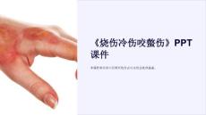 《烧伤冷伤咬螫伤》课件