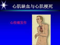 心肌缺血心肌梗死 ppt课件
