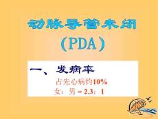 动脉导管未闭PDA课件