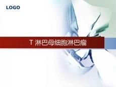 T淋巴母细胞淋巴瘤