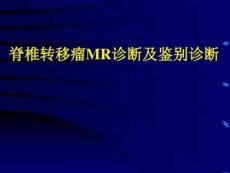 脊柱转移瘤的诊断和鉴别诊断课件
