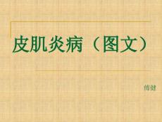 皮肌炎病（图文）课件