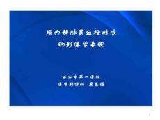 颅内静脉窦血栓形成影像学表现课件
