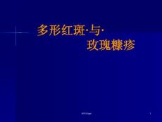 多形红斑与玫瑰糠疹课件
