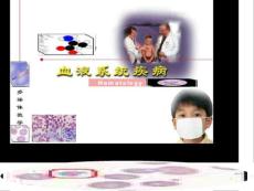 急性淋巴细胞白血病ppt课件