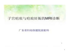 子宫疤痕与疤痕妊娠MRI诊断课件