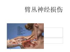 臂丛神经损伤课件