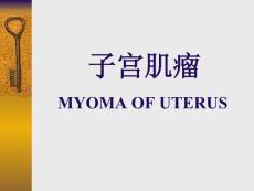 子宫肌瘤-课件