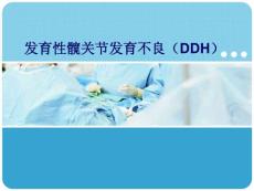 发育性髋关节发育不良课件