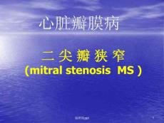 二尖瓣狭窄医学课件