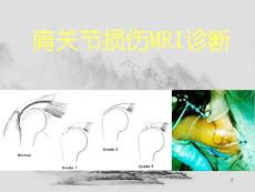 肩关节损伤MRI诊断课件