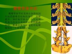 腰椎椎管狭窄症课件