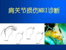 肩关节损伤MRI诊断ppt课件