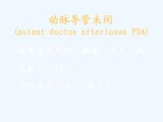 动脉导管未闭