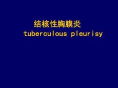结核性胸膜炎