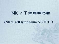 NK／T细胞淋巴瘤.ppt