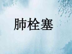 肺栓塞ppt