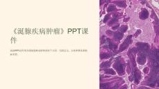 《涎腺疾病肿瘤》课件
