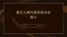 新生儿寒冷损伤综合征图片ppt
