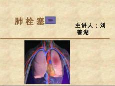 肺栓塞